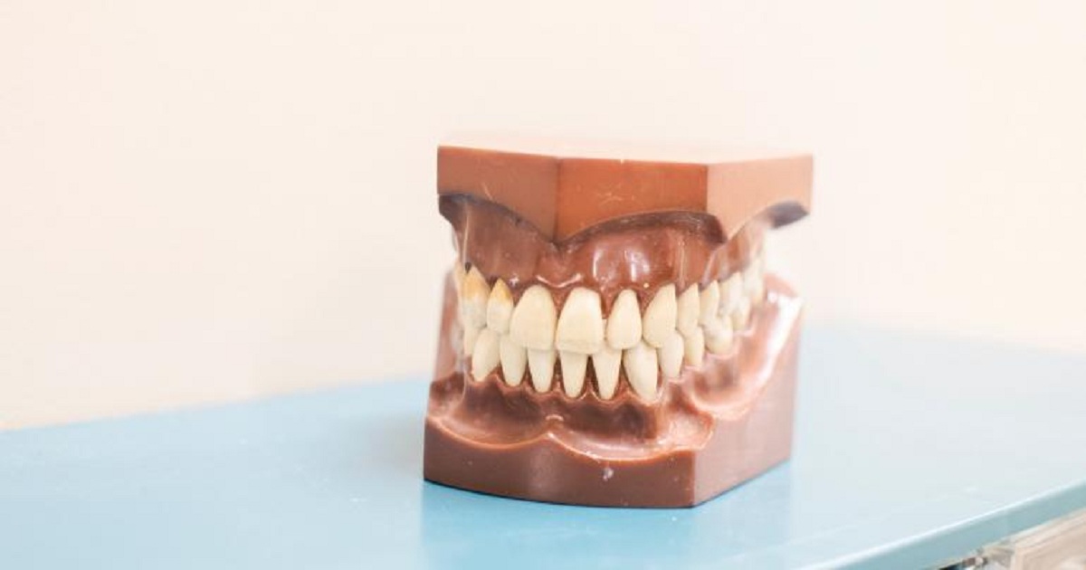3D Printing Gives Manufacturer Teeth