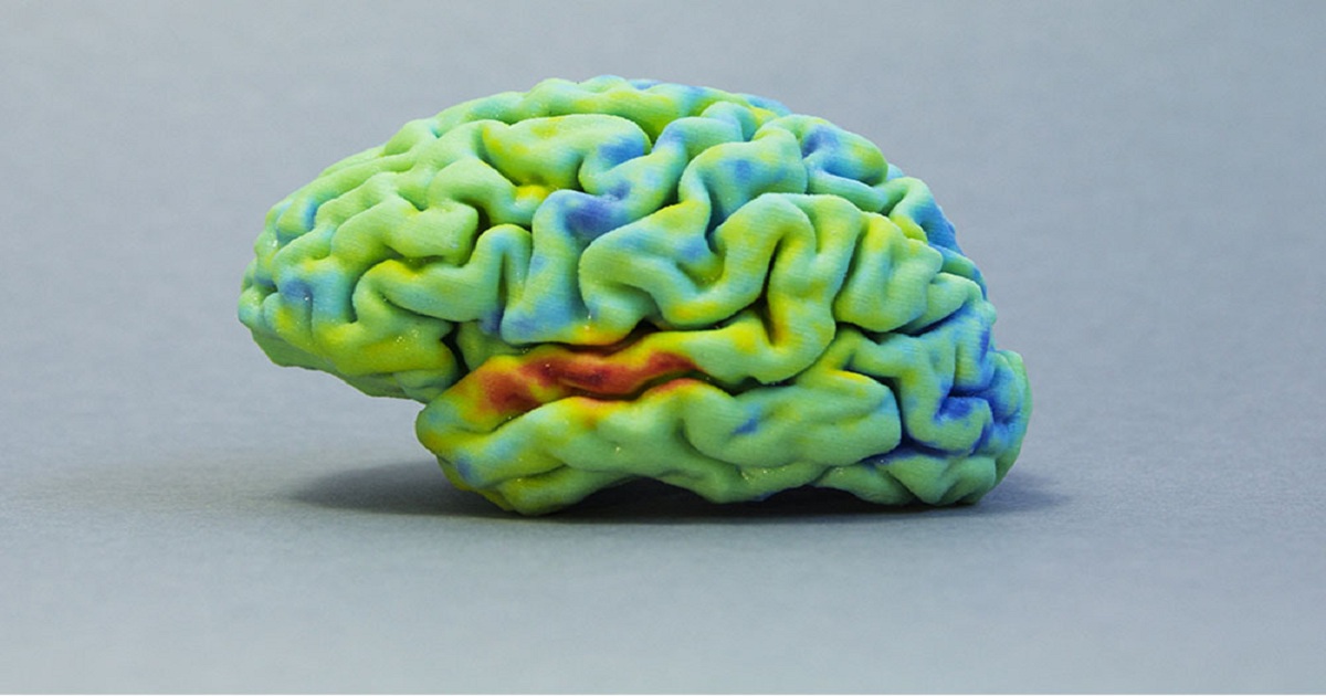 MEDICAL 3D PRINTING: DISCOVER THE 3D PRINTED BRAIN